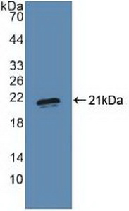 Polyclonal Antibody to PR Domain Containing Protein 1 (PRDM1)