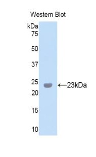 Polyclonal Antibody to Peroxidasin Homolog (PXDN)