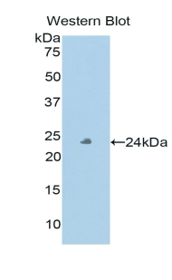 Polyclonal Antibody to Peroxidasin Homolog (PXDN)