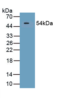 Polyclonal Antibody to Secreted And Transmembrane Protein 1 (SECTM1)