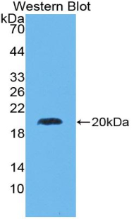 Polyclonal Antibody to Suppressor Of Ty 6 Homolog (SUPT6H)