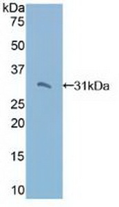 Polyclonal Antibody to TNFRSF1A Associated Via Death Domain Protein (TRADD)