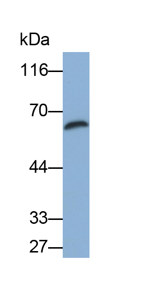 Polyclonal Antibody to POTE Ankyrin Domain Family, Member G (POTEG)