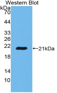 Polyclonal Antibody to POTE Ankyrin Domain Family, Member G (POTEG)