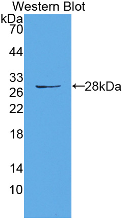 Polyclonal Antibody to HAUS Augmin Like Complex Subunit 7 (HAUS7)