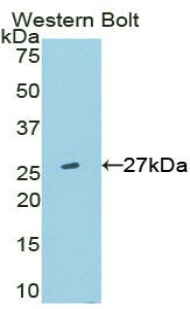 Polyclonal Antibody to Transmembrane Protein 173 (TME<b>M173</b>)