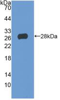 Polyclonal Antibody to T-Cell Immunoreceptor With Ig And ITIM Domains Protein (TIGIT)