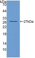 Polyclonal Antibody to T-Cell Immunoreceptor With Ig And ITIM Domains Protein (TIGIT)