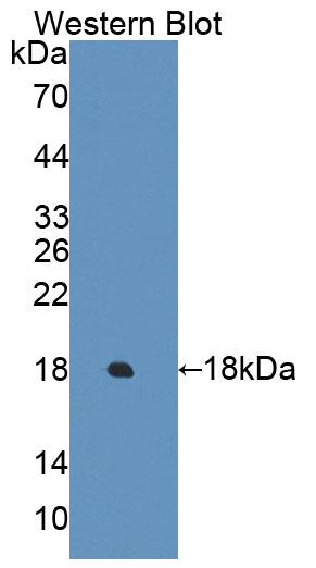 Polyclonal Antibody to Esophageal Cancer Related Gene 4 (ECRG4)