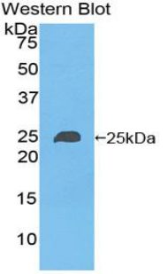 Polyclonal Antibody to Non Metastatic Cells 6, Protein Expressed In (NME6)