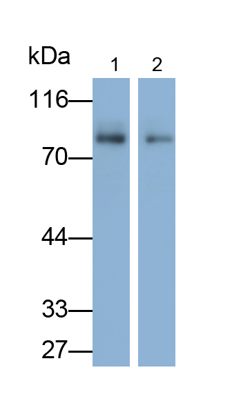 Polyclonal Antibody to Hermansky Pudlak Syndrome Protein 6 (HPS6)