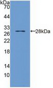 Polyclonal Antibody to Toll Interleukin 1 Receptor Domain Containing Adaptor Protein (TIRAP)