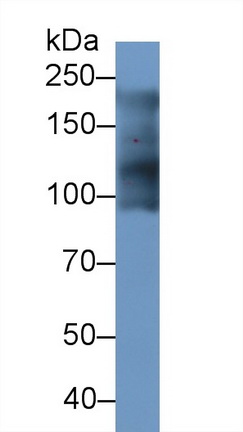 Polyclonal Antibody to Myosin Heavy Chain 7B, Cardiac Muscle Beta (MYH7B)