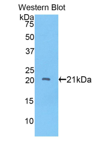 Polyclonal Antibody to A Disintegrin And Metalloproteinase With Thrombospondin 12 (ADAMTS12)
