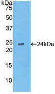Polyclonal Antibody to Linker For Activation Of T-Cells Family, Member 2 (LAT2)