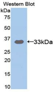 PAP657Hu01.jpg