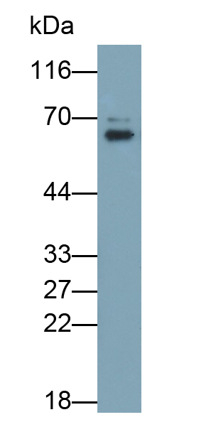 PAP751Hu01.jpg
