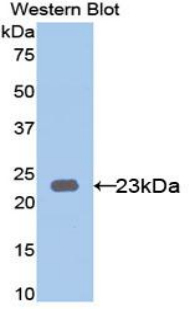 Polyclonal Antibody to Keratin 23 (KRT23)