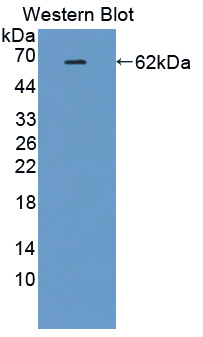 Polyclonal Antibody to IK Cytokine, Down Regulator Of HLA II (IK)
