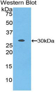 Polyclonal Antibody to Leucine Rich Repeat Containing Protein 32 (LRRC32)