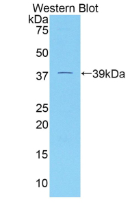Polyclonal Antibody to Dickkopf Related Protein 4 (DKK4)