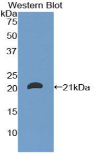 Polyclonal Antibody to Cluster Of Differentiation 8b (CD8b)