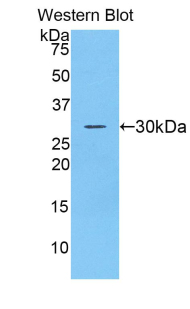 Polyclonal Antibody to A Disintegrin And Metalloprotease 20 (ADAM20)