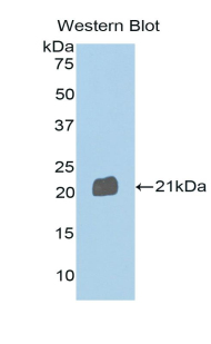 Polyclonal Antibody to Semaphorin 4B (SEMA4B)