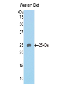 Polyclonal Antibody to Semaphorin 4B (SEMA4B)