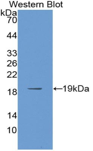 Polyclonal Antibody to Poly A Binding Protein Cytoplasmic 1 Like Protein (PABPC1L)