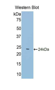 Polyclonal Antibody to Poly A Binding Protein Cytoplasmic 1 Like Protein (PABPC1L)