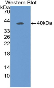 Polyclonal Antibody to Defensin Beta 119 (DEF<b>b119</b>)