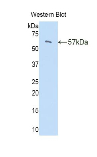 Polyclonal Antibody to Peptidase Inhibitor 16 (PI16)