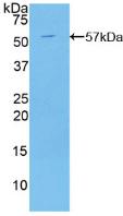 Polyclonal Antibody to C2 Calcium Dependent Domain Containing Protein 3 (C2CD3)