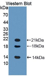 Polyclonal Antibody to Ly1 Antibody Reactive Homolog (LYAR)