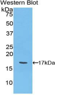 Polyclonal Antibody to Ly1 Antibody Reactive Homolog (LYAR)