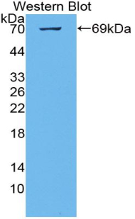 Polyclonal Antibody to Cancerous Inhibitor Of PP2A (CIP2A)