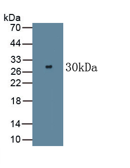 Polyclonal Antibody to Mucin (MUC)