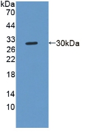 Polyclonal Antibody to Notch2 N-Terminal Like Protein (NOTCH2NL)