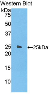 Polyclonal Antibody to Folate Receptor 4 (FOLR4)