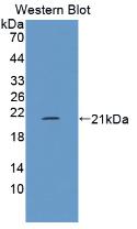 Polyclonal Antibody to Filaggrin 2 (FLG2)