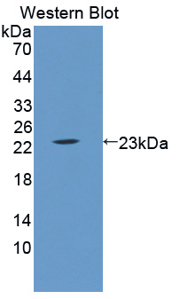 Polyclonal Antibody to Lipocalin 5 (LCN5)