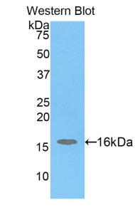 Polyclonal Antibody to H2A Histone Family, Member J (H2AFJ)