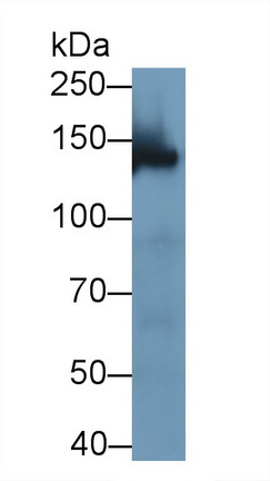 Polyclonal Antibody to WW And C2 Domain Containing Protein 3 (WWC3)