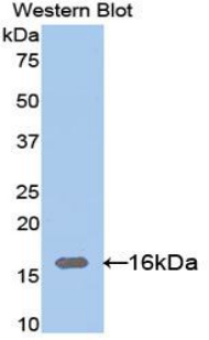 Polyclonal Antibody to Galectin 9C (GAL9C)