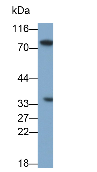 Polyclonal Antibody to Galectin 9C (GAL9C)