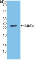 Polyclonal Antibody to Angiopoietin Like Protein 8 (ANGPTL8)