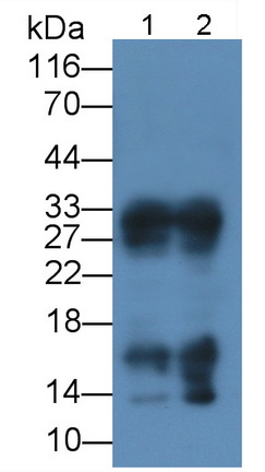 Recombinant Antibody to Insulin Like Growth Factor 1 (IGF1)