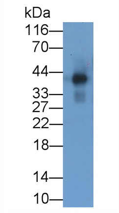 Recombinant Antibody to Procollagen I N-Terminal Propeptide (PINP)