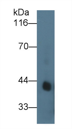 Recombinant Antibody to Procollagen I N-Terminal Propeptide (PINP)